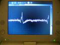 ECG Prototype 1