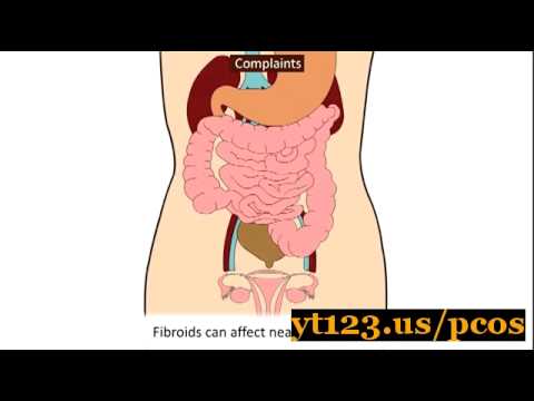 how to dissolve cysts