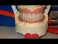 Implantes Dentales \"Soluciones Pr�tesicas\"