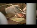 Part 2 - Mexico Border Dentist Dayo Dental Company
