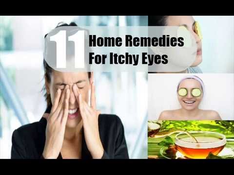 how to cure itchy eyes