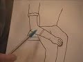 Manic Depression /Bipolar Disorder