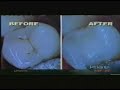 Dr.Payam Ataii,KTLA Laser Dentistry Dr.Payam Ataii,KTLA Laser Dentistry