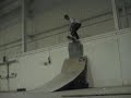 Dave Edwards A skateboard accident