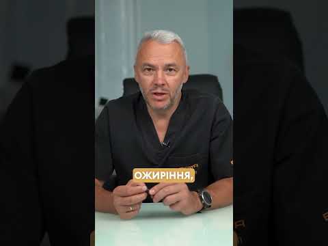 Полипы в полости матки – что провоцирует?