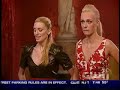 Model Caridee English The Face For Psoriasis Foundation