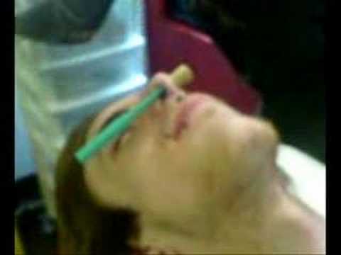 septum dermally punched above my lower septum. missing earlobe on the right, 