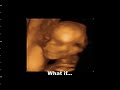 MacInnes-Cann Baby #2