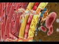 MAGICAL coronary stent system MAGICAL coronary stent system