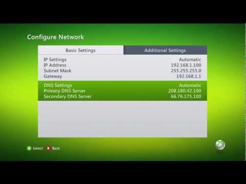 how to nat xbox