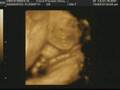 Bella Samaniego 1st Video -3D Ultra Sound