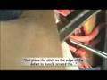 Ventricular Septal Defect (VSD) Surgical Repair - Pediatric Heart Surgery