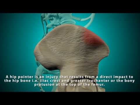 how to relieve snapping hip