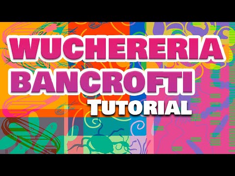 how to treat wuchereria bancrofti