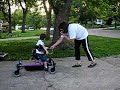 Holoprosencephaly, Ryland in Walker