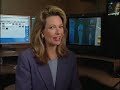 Joint-Saving Knee Surgery-Mayo Clinic
