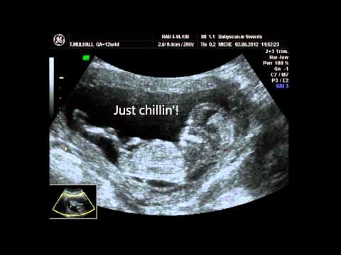 Dating scan at 12 weeks amature fingering any