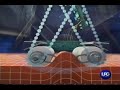 LPG Endermologie LPG Endermologie