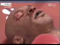 Tyson vs. Lewis knock out punch