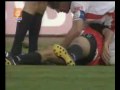 Football injury