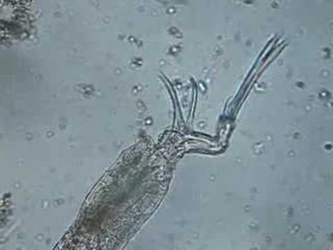 rotifer
