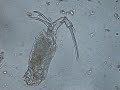 rotifer rotifer