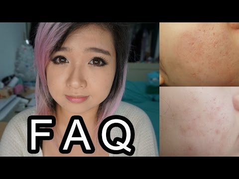 how to get rid of acne z.com