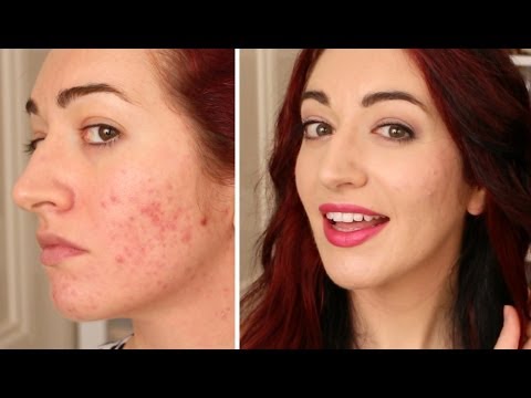 how to apply bb cream on acne