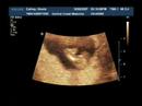 baby-cathey-12-weeks-part-3.html