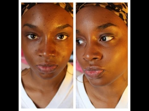 how to get rid of acne and dark spots
