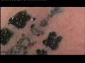 Sak Yant Tattoo Samnak Ajarn Noo Kanpai