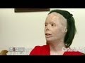 Violenza sulle donne - L'inferno di Valentina Pitzalis e la sua forza