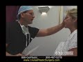 Upper Blepharoplasty (Eyes) and Face Lift, Dr. Cruise