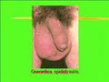 GONORRHEA-The-Movie