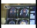 videos de ScienceFlash 44 - DJ Hersenscan Reportage
