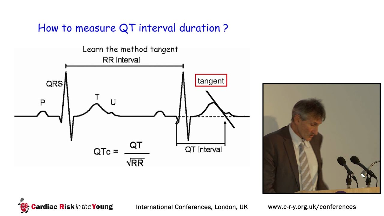 QT-interval in young athletic individuals; The Long and short of it