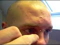 Nostril piercing DIY - Do it Yourself