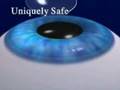 lasik surgery costs