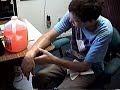 kibler dislocated elbow