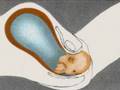 What happens at Child Birth ?