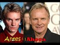 Antes y Ahora