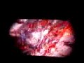 1125081803.3g2 1125081803.3g2