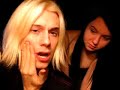 bells palsy