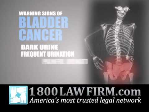 Actos Leads to Bladder Cancer