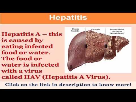 how to get rid from hepatitis b