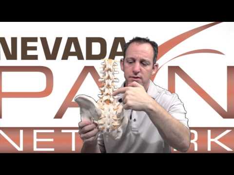 how to treat arthritis in the neck