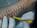 Scarification by Kat