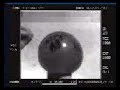 Explosión globo de agua