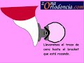 El uso de la cera de ortodoncia El uso de la cera de ortodoncia