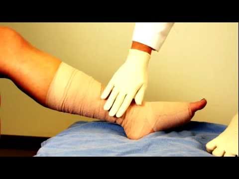 how to make your ulcer bleed